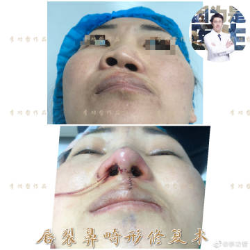 李功哲医生