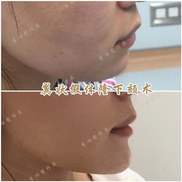李功哲