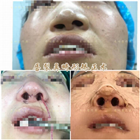 李功哲整形医生
