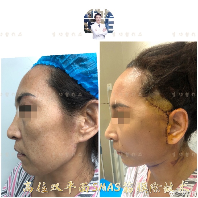 李功哲
