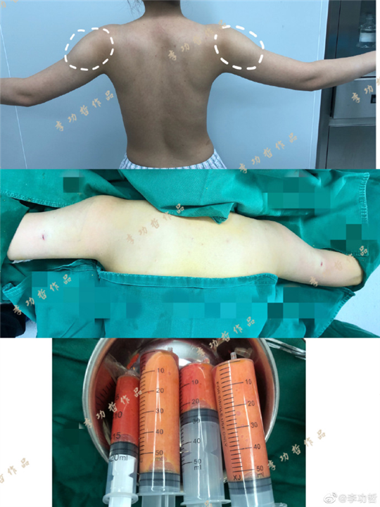 李功哲医生