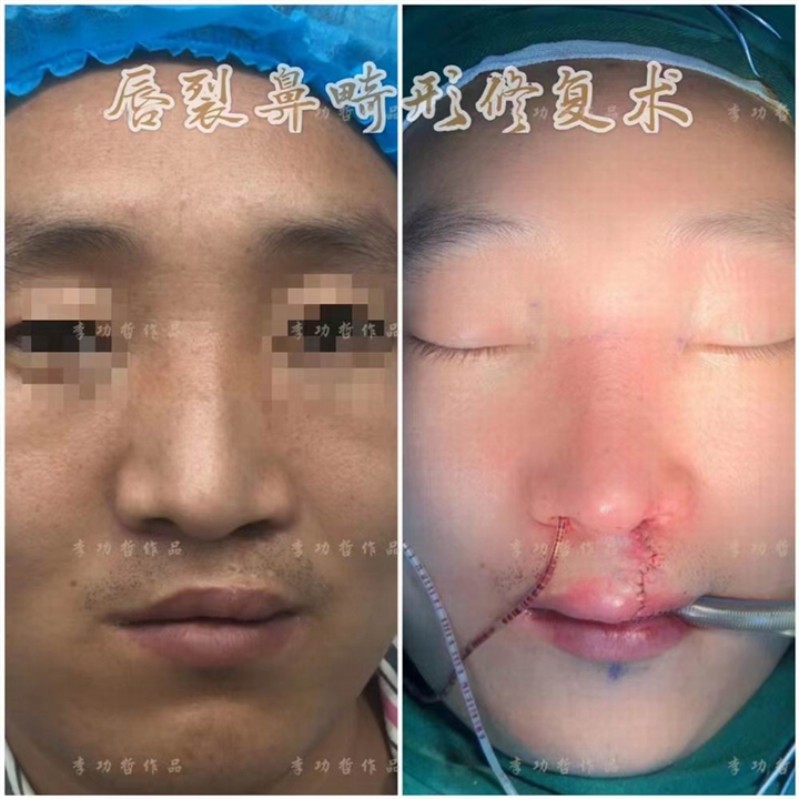 李功哲