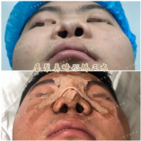 李功哲医生