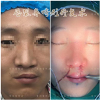 李功哲