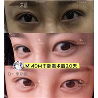 李功哲整形医生