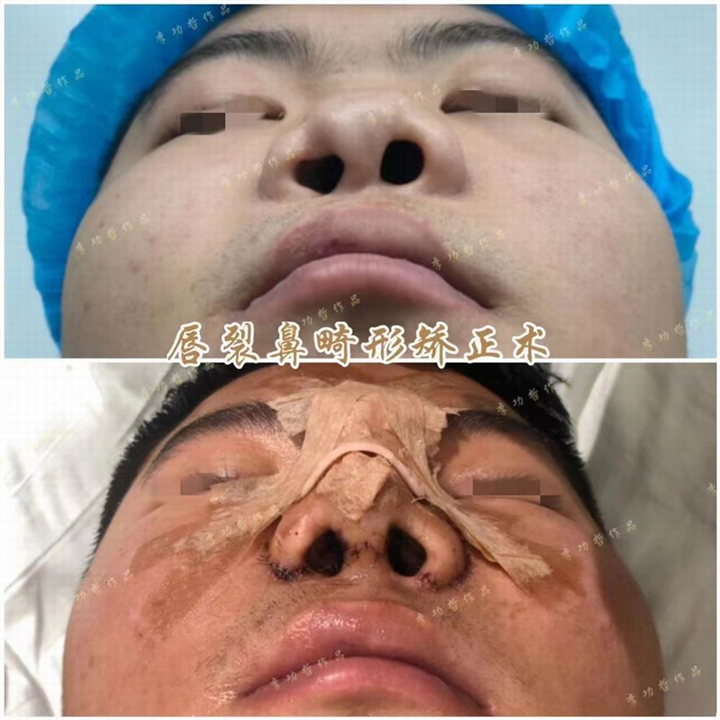 李功哲医生