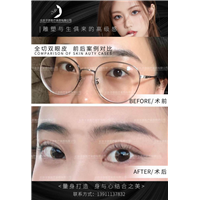 王子彦双眼皮