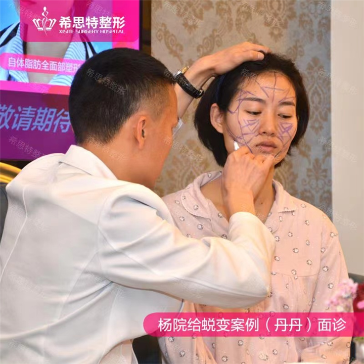 杨权明医生设计面诊中