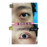 深圳眼综合整形|深圳鼻综合哪家好