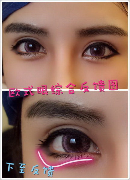 深圳眼综合整形|深圳鼻综合哪家好