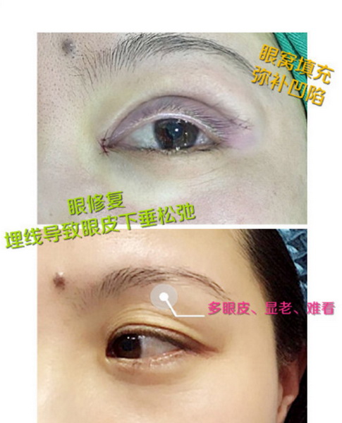 深圳鼻综合哪家好|深圳眼综合哪家好