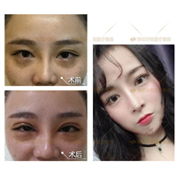 深圳软肋骨鼻综合|深圳眼综合整形