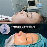 郑勇医生分享直鼻OR翘鼻，你适合哪款鼻型？