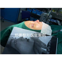 郑勇整形医生