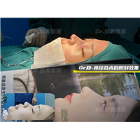 郑勇医生做鼻子怎么样