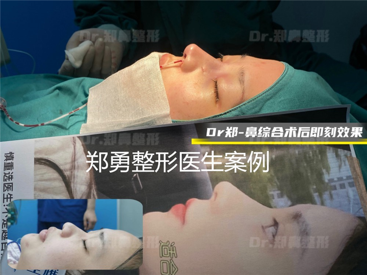 长沙做鼻子哪个医生做的好