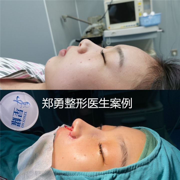 长沙鼻综合整形医生