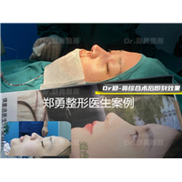长沙做鼻子哪个医生做的好