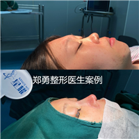 郑勇眼鼻整形修复医生