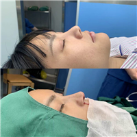 郑勇整形医生