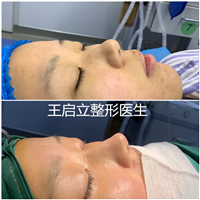 王启立