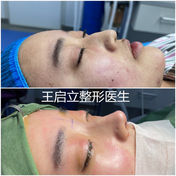 王启立