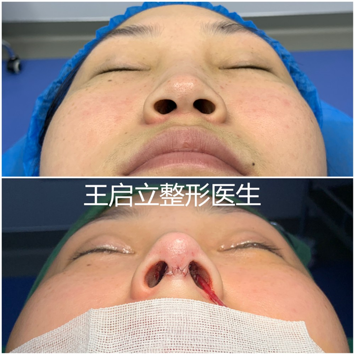 王启立