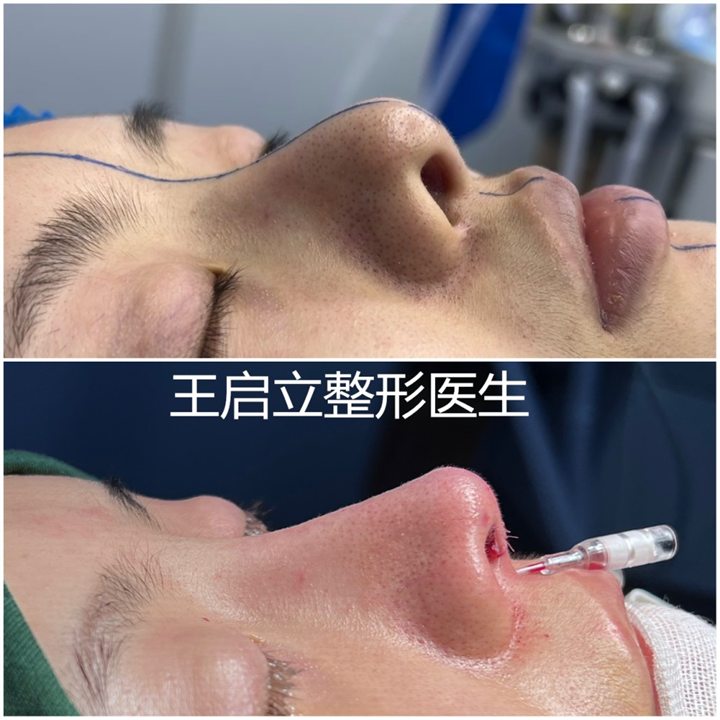 王启立