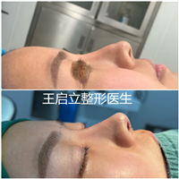 王启立医生