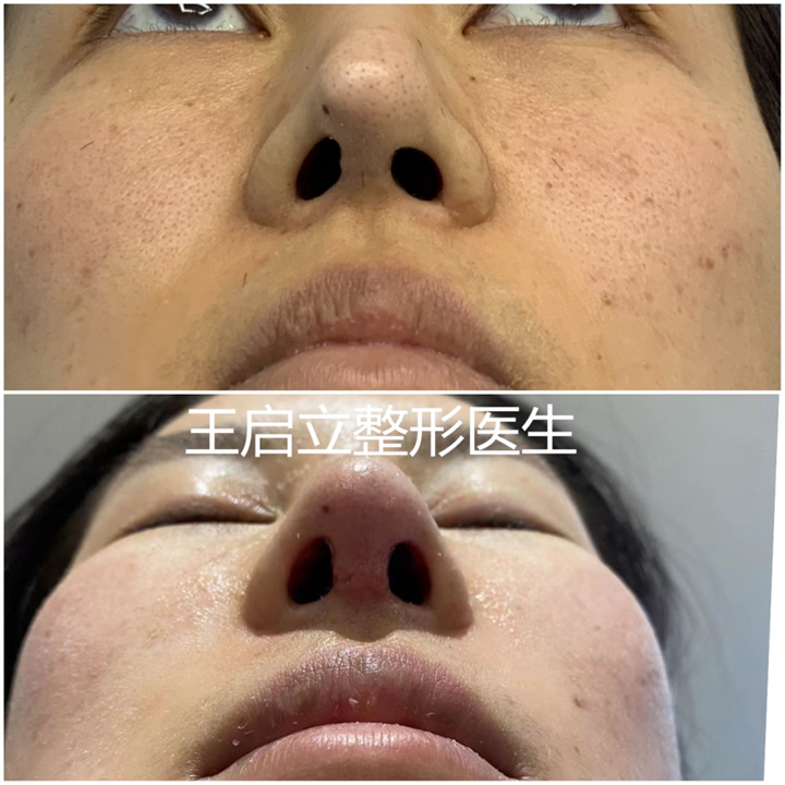 王启立