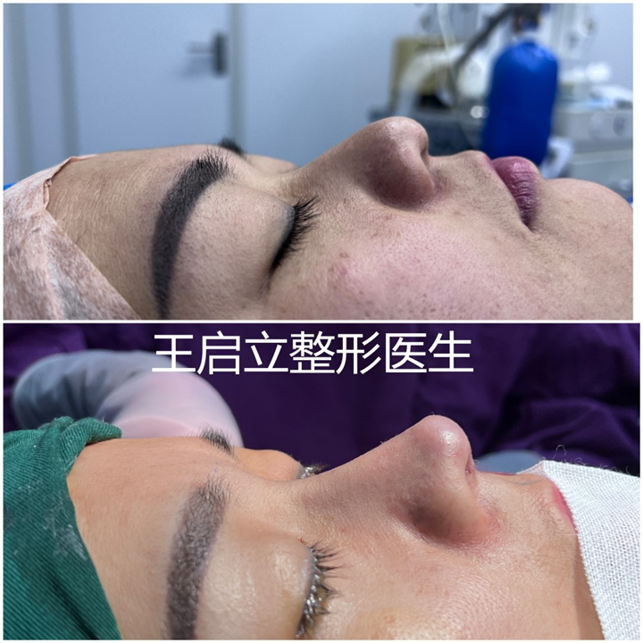 王启立整形医生
