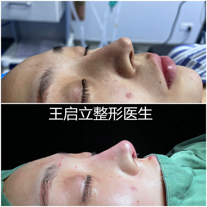 王启立