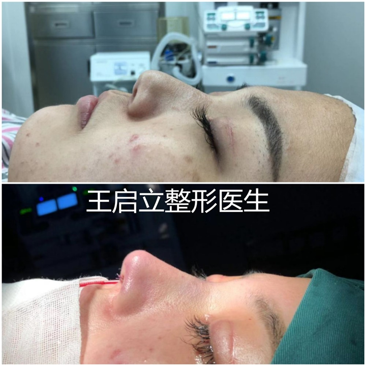 河南鼻整形医生
