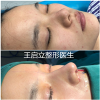 王启立医生