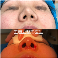 王启立