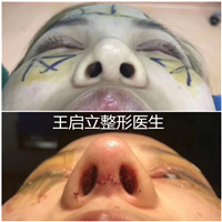 王启立医生