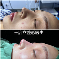郑州鼻整形医生