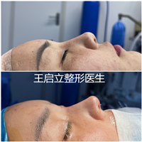 郑州鼻整形医生
