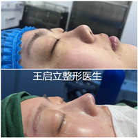 王启立