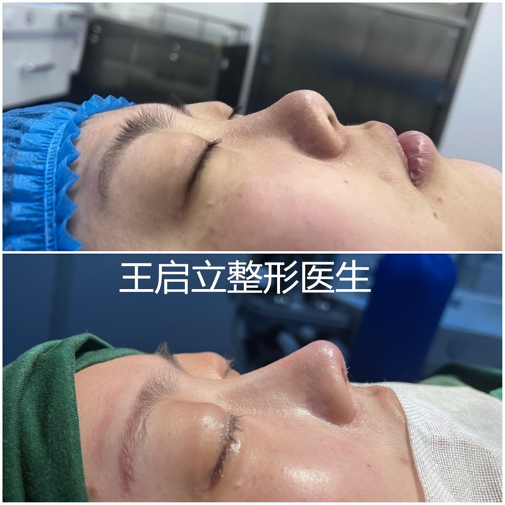王启立