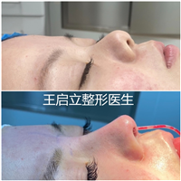 王启立医生