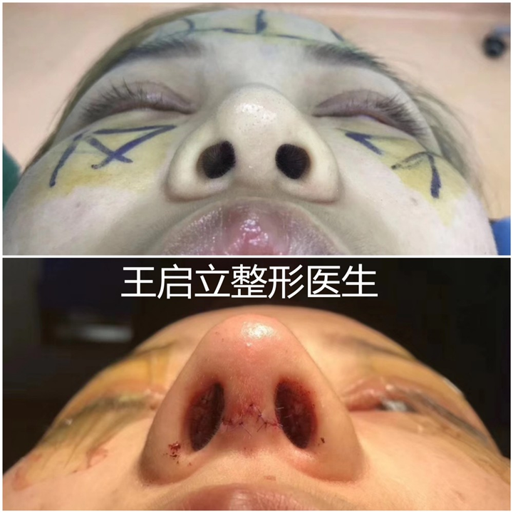 王启立医生