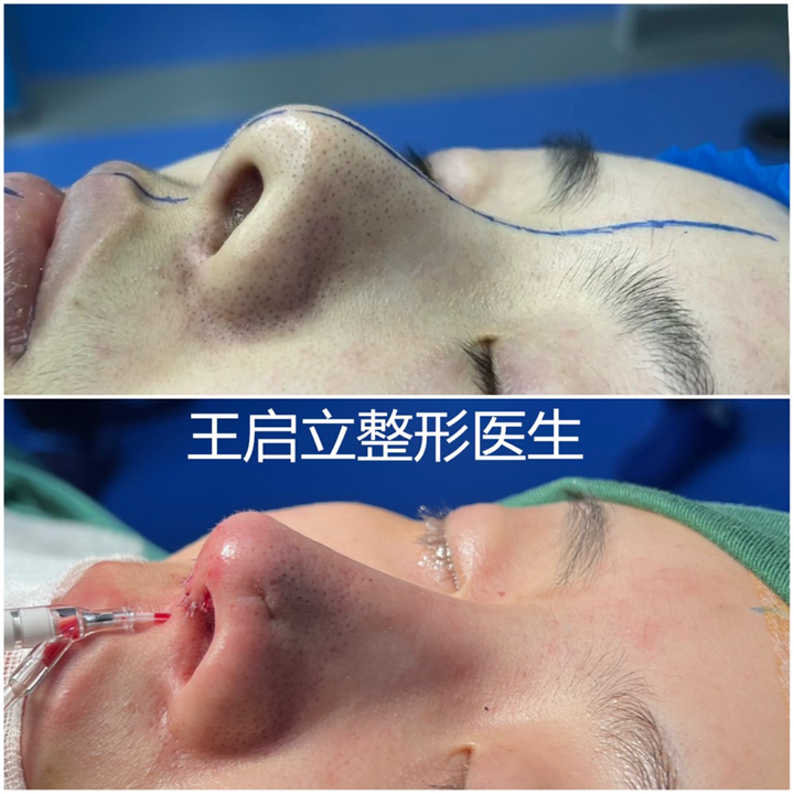 王启立