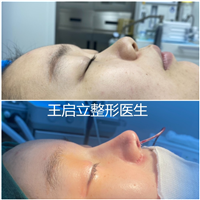 王启立医生