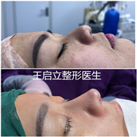 王启立