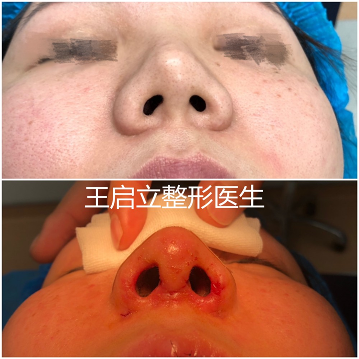 王启立