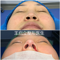 王启立
