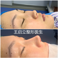 王启立