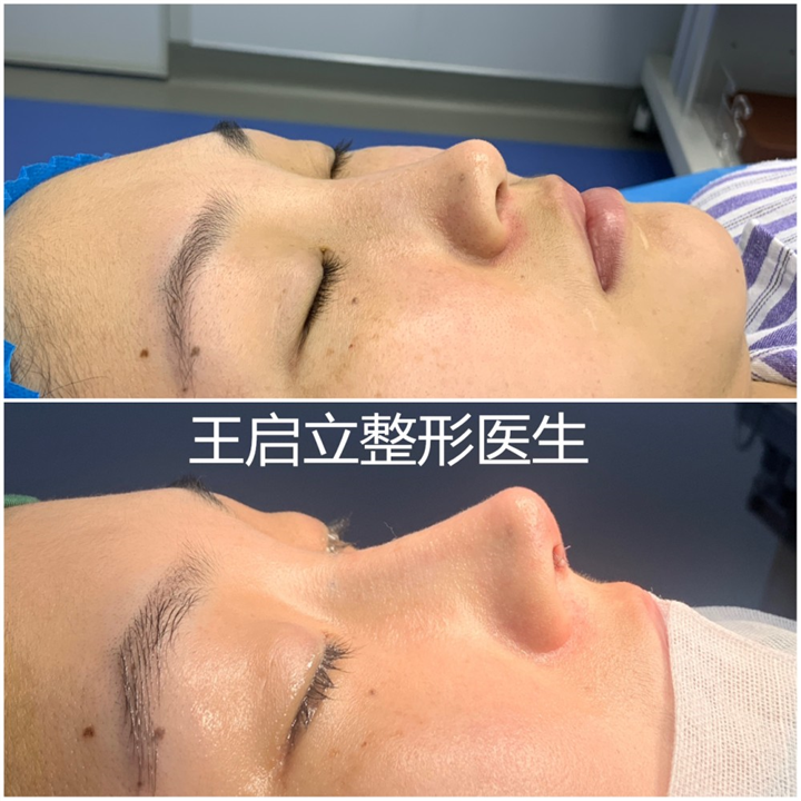 王启立