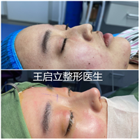 王启立
